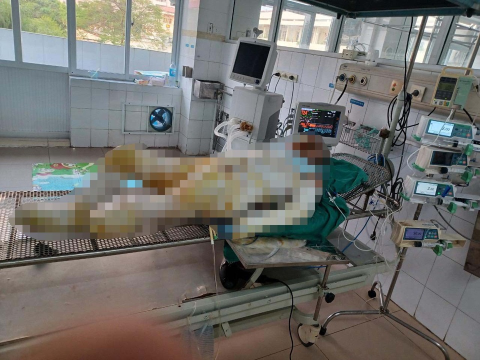 Vụ con gái phóng hỏa nhà mẹ: Người mẹ đã thực hiện 2 cuộc phẫu thuật